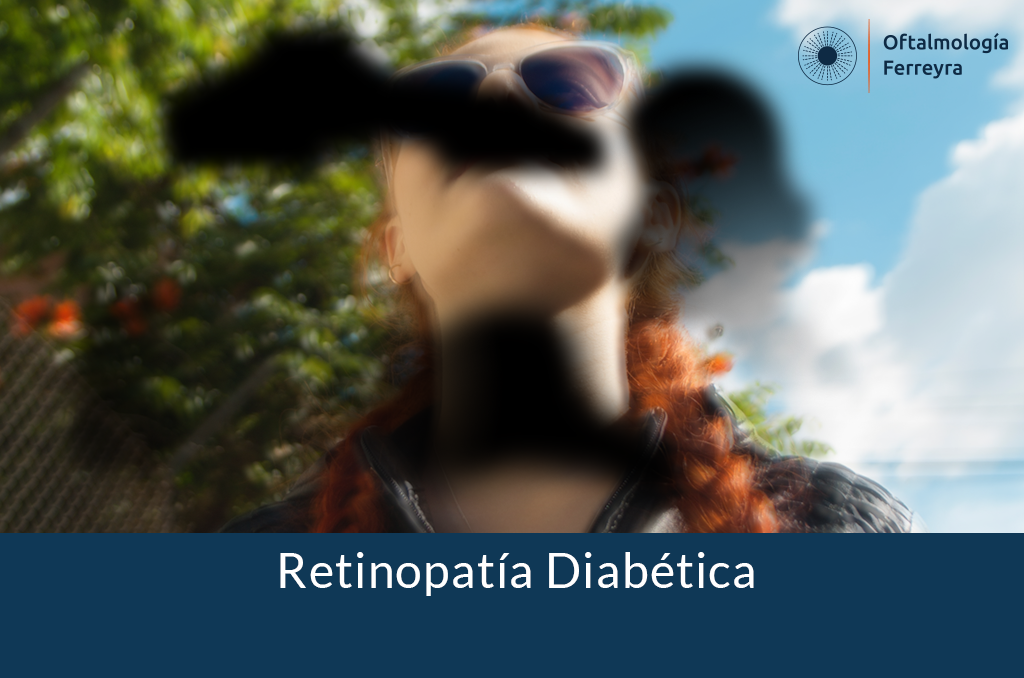 vista con retinopatía diabética